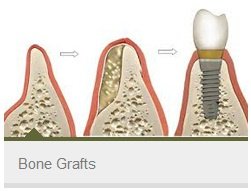كابيتال لطب الأسنان - Capital Dentistry