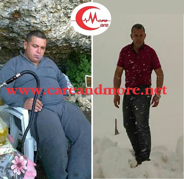 Care And More - Obesity Solutions - Edirne . - Care And More - Obesity Solutions - Edirne .