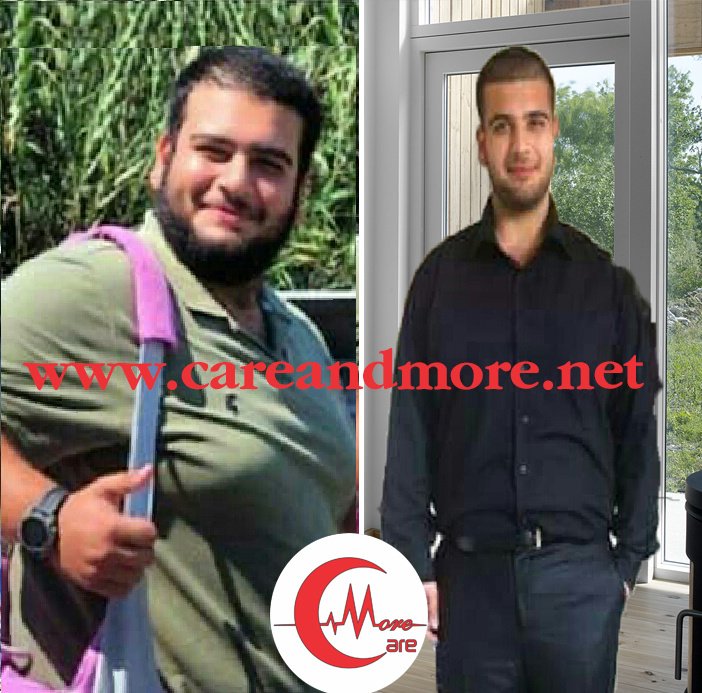 Care And More - Obesity Solutions - Edirne . - Care And More - Obesity Solutions - Edirne .