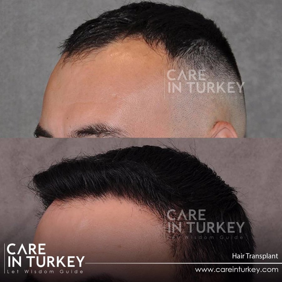 Care in Turkey - Care in Turkey