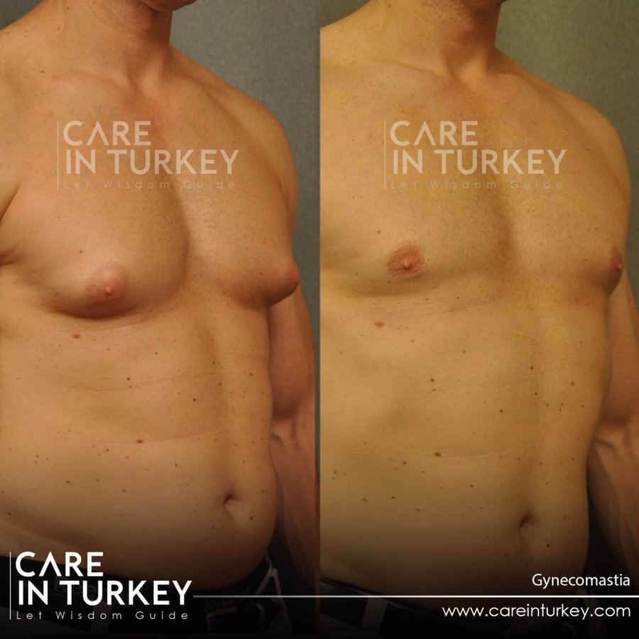Care in Turkey - Care in Turkey