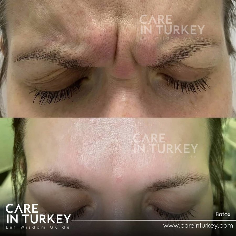 Care in Turkey - Care in Turkey