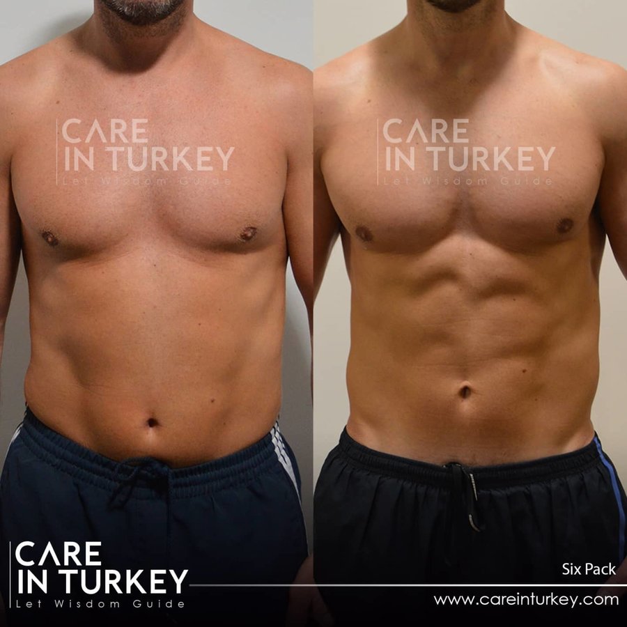 Care in Turkey - Care in Turkey