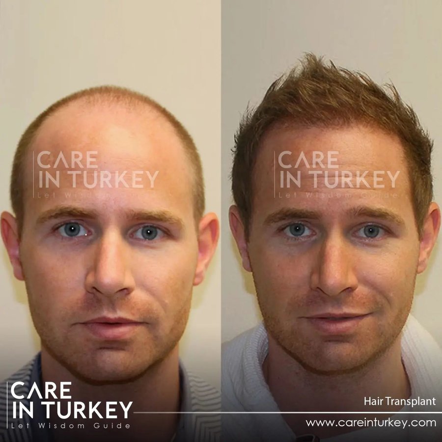 Care in Turkey - Care in Turkey