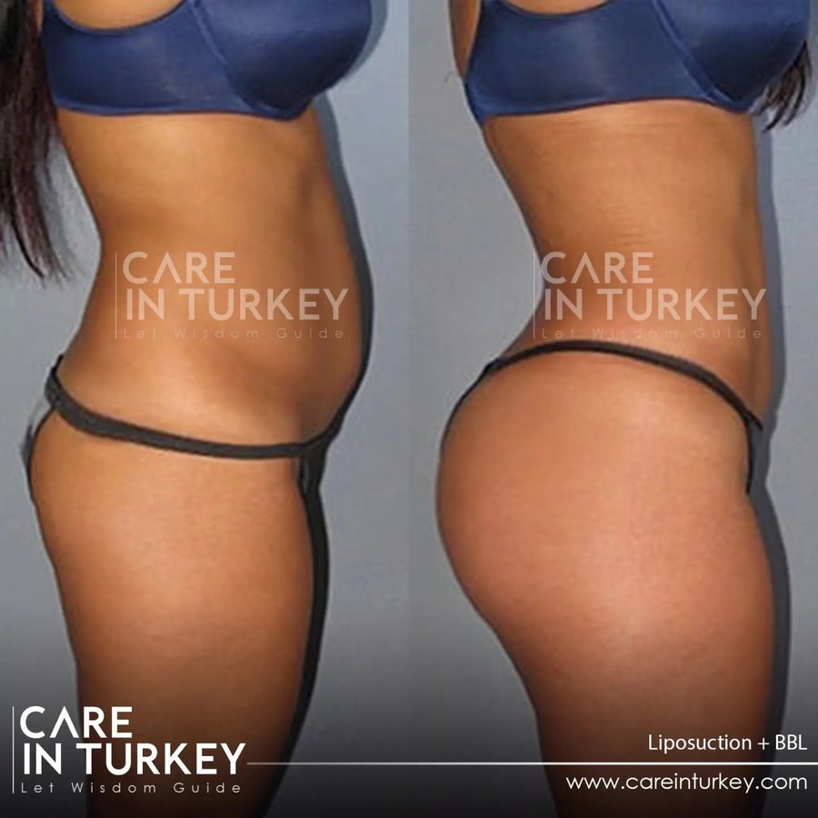 Care in Turkey - Care in Turkey