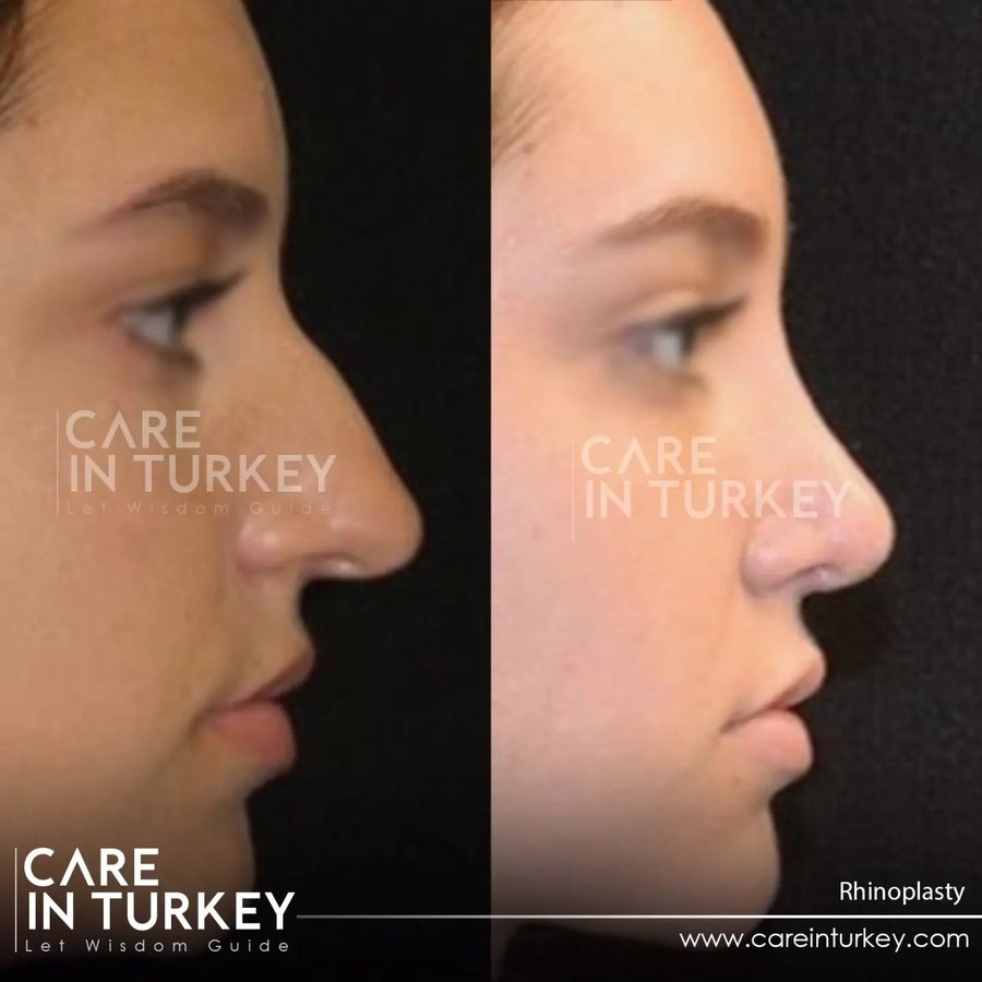 Care in Turkey - Care in Turkey