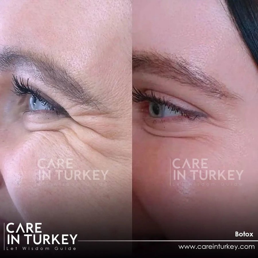 Care in Turkey - Care in Turkey