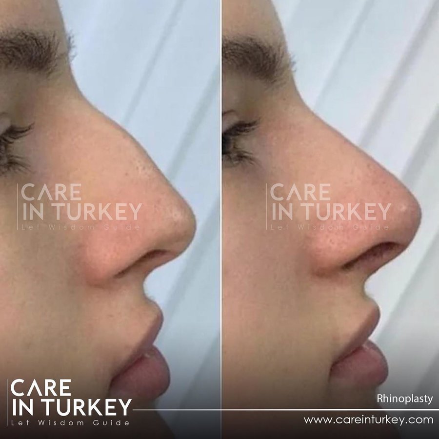 Care in Turkey - Care in Turkey