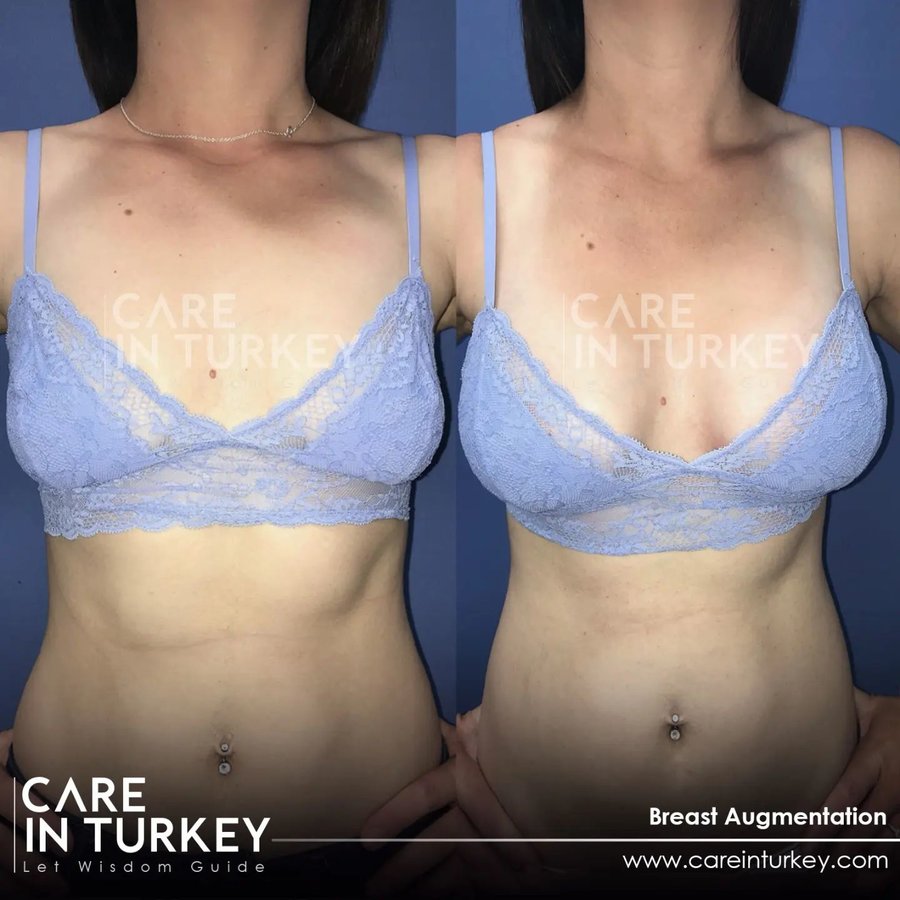 Care in Turkey - Care in Turkey