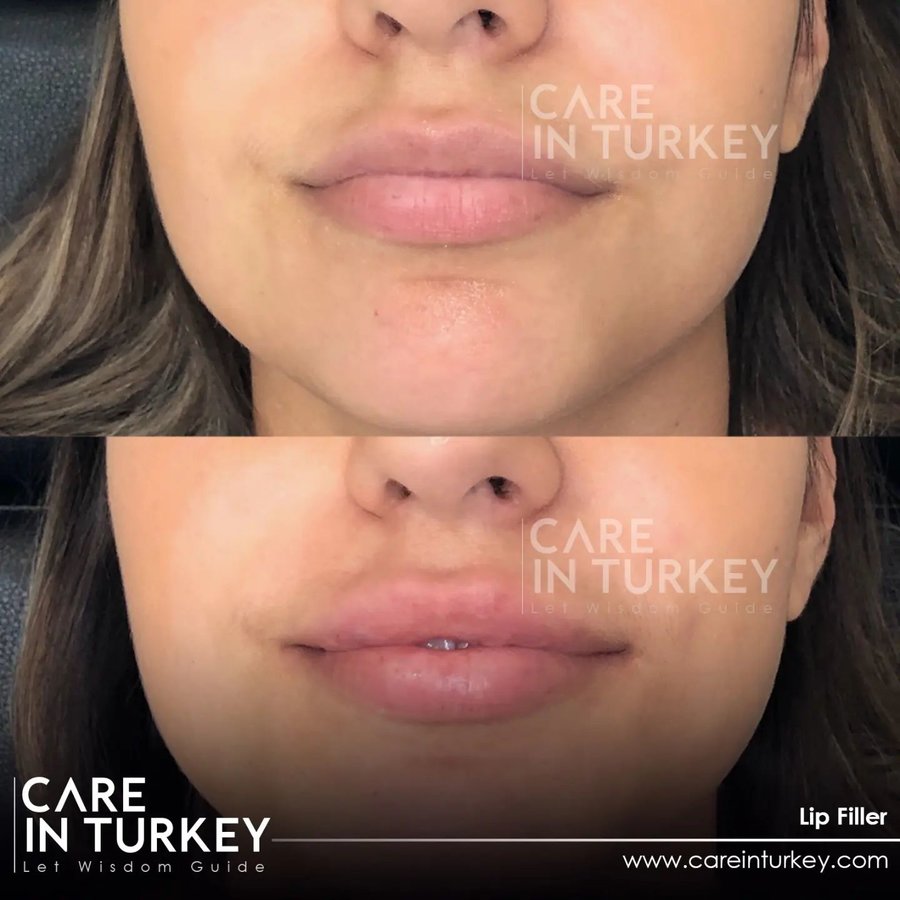 Care in Turkey - Care in Turkey