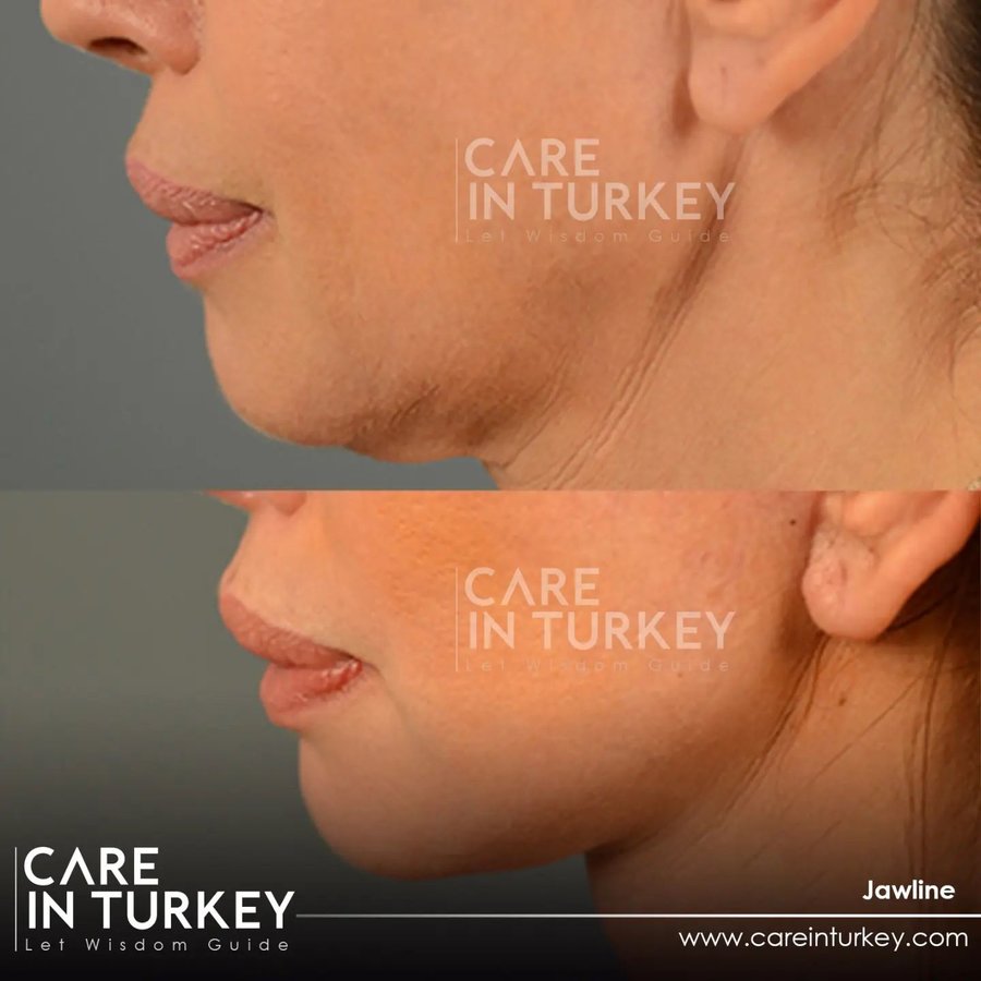 Care in Turkey - Care in Turkey