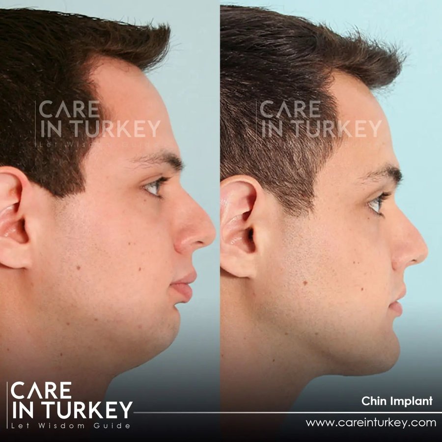 Care in Turkey - Care in Turkey