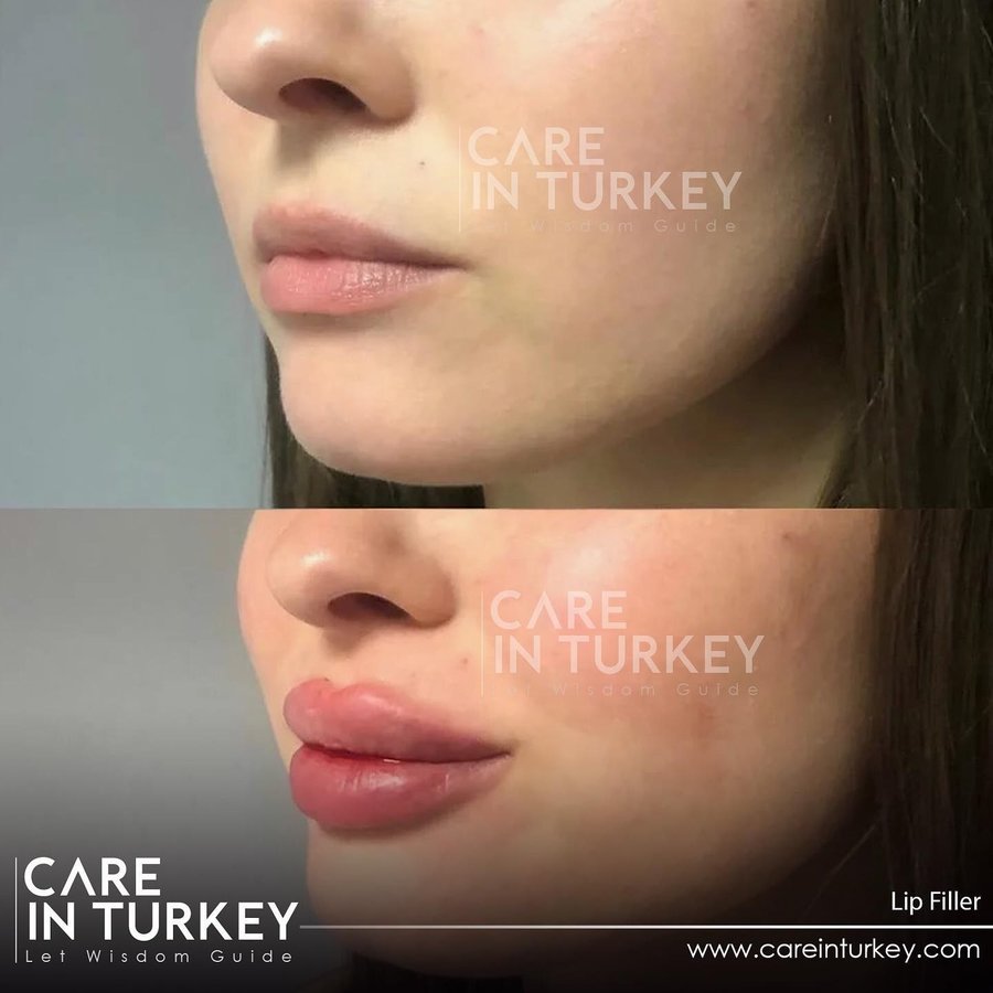 Care in Turkey - Care in Turkey