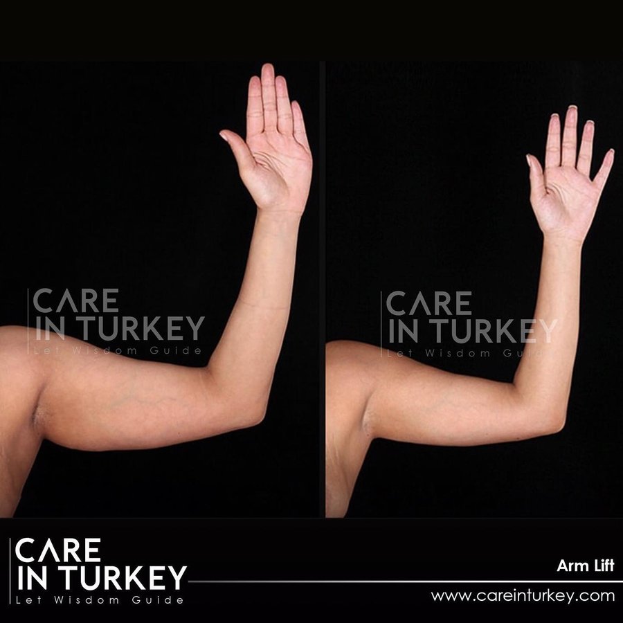 Care in Turkey - Care in Turkey