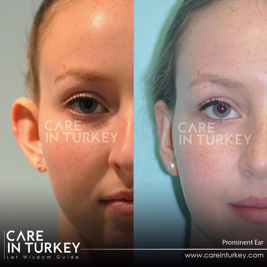 Care in Turkey - Care in Turkey
