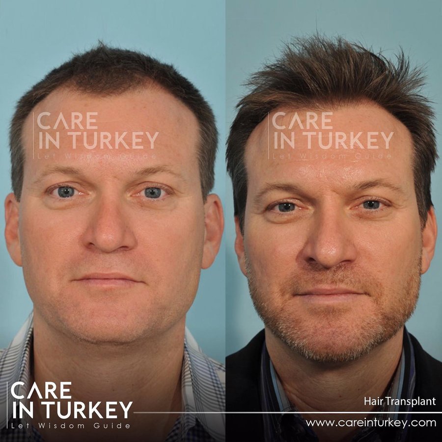 Care in Turkey - Care in Turkey