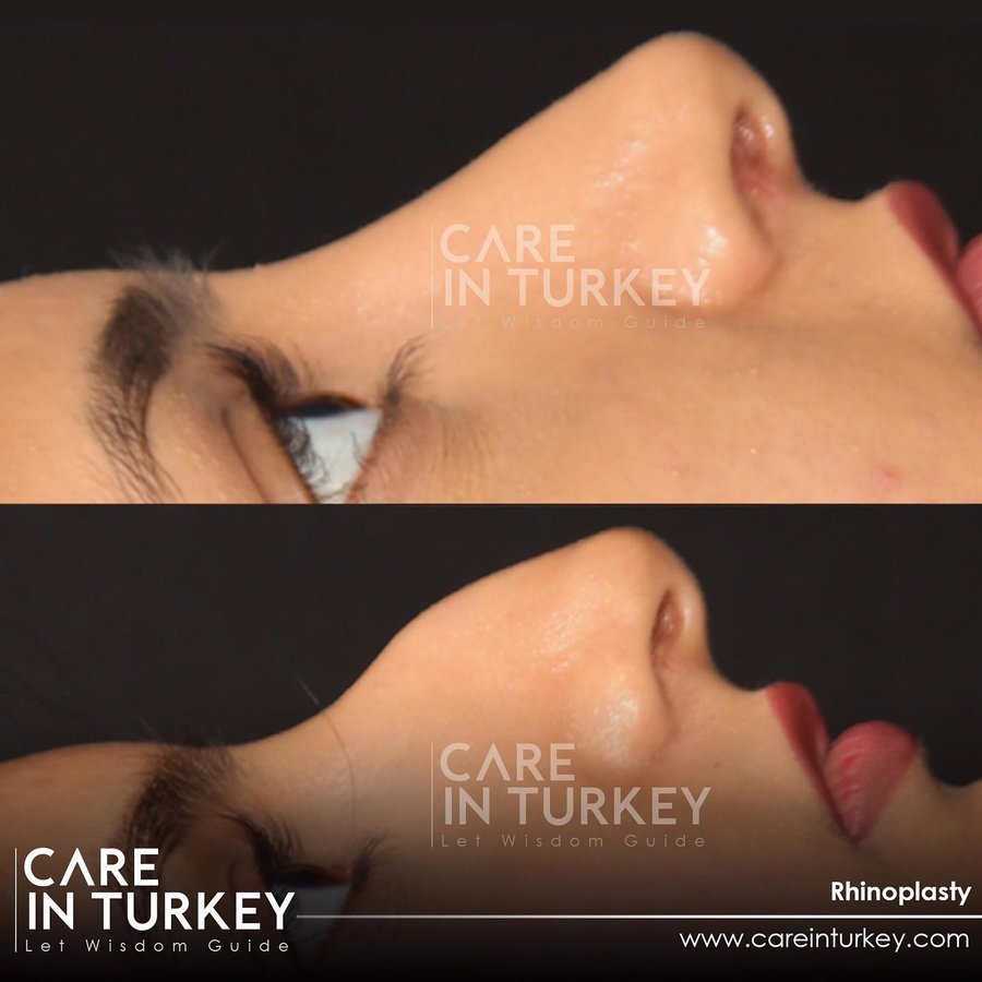 Care in Turkey - Care in Turkey