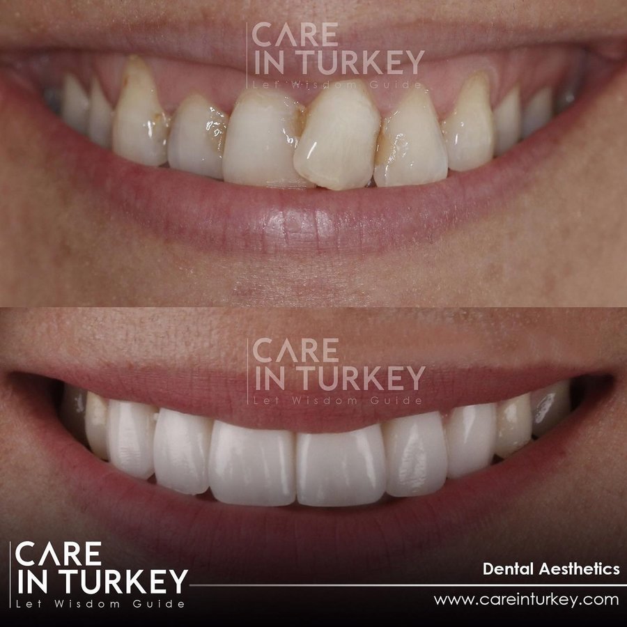 Care in Turkey - Care in Turkey