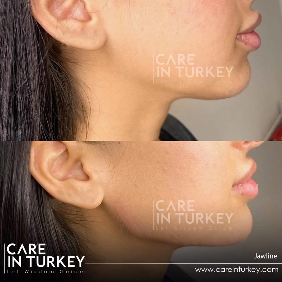 Care in Turkey - Care in Turkey