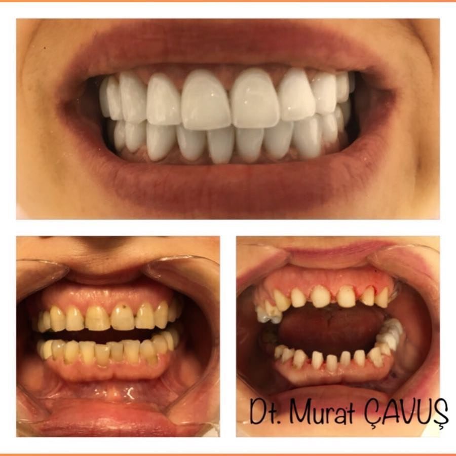 كافوس كلينيك - Cavus klinic