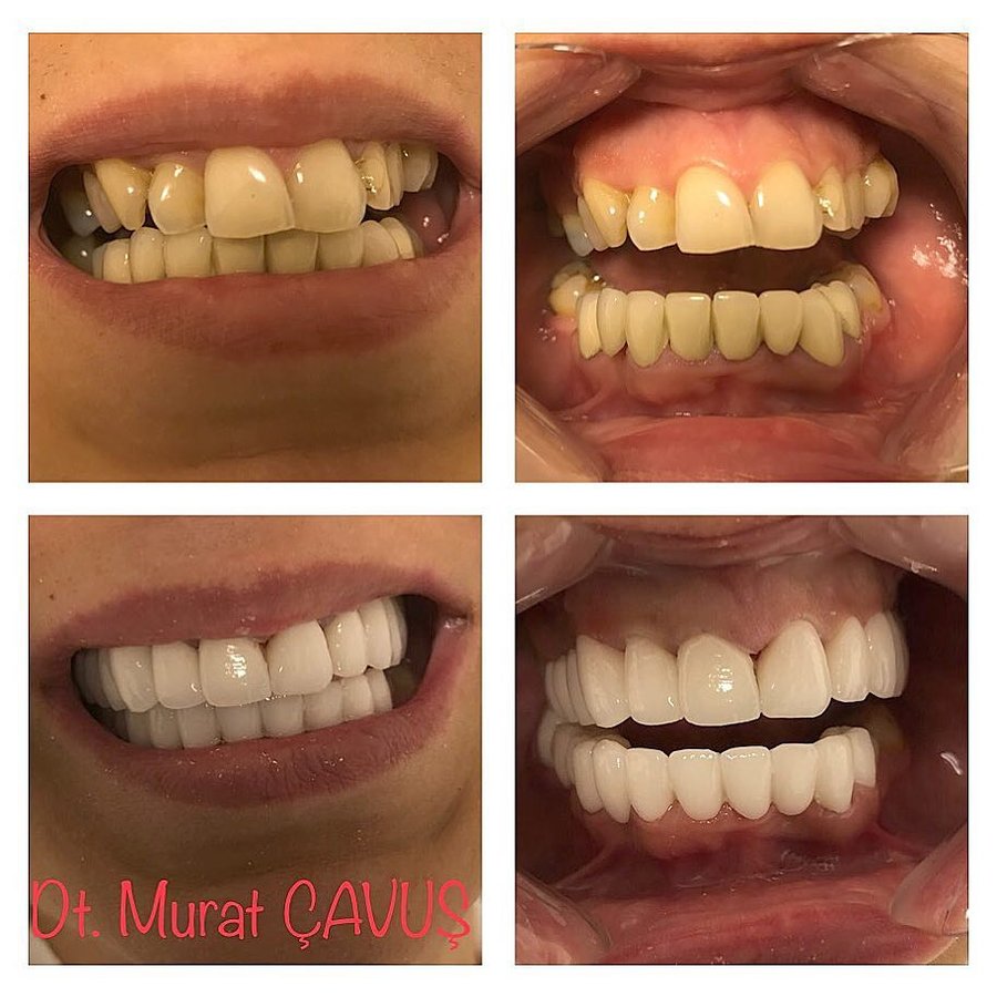كافوس كلينيك - Cavus klinic