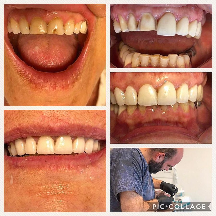 كافوس كلينيك - Cavus klinic