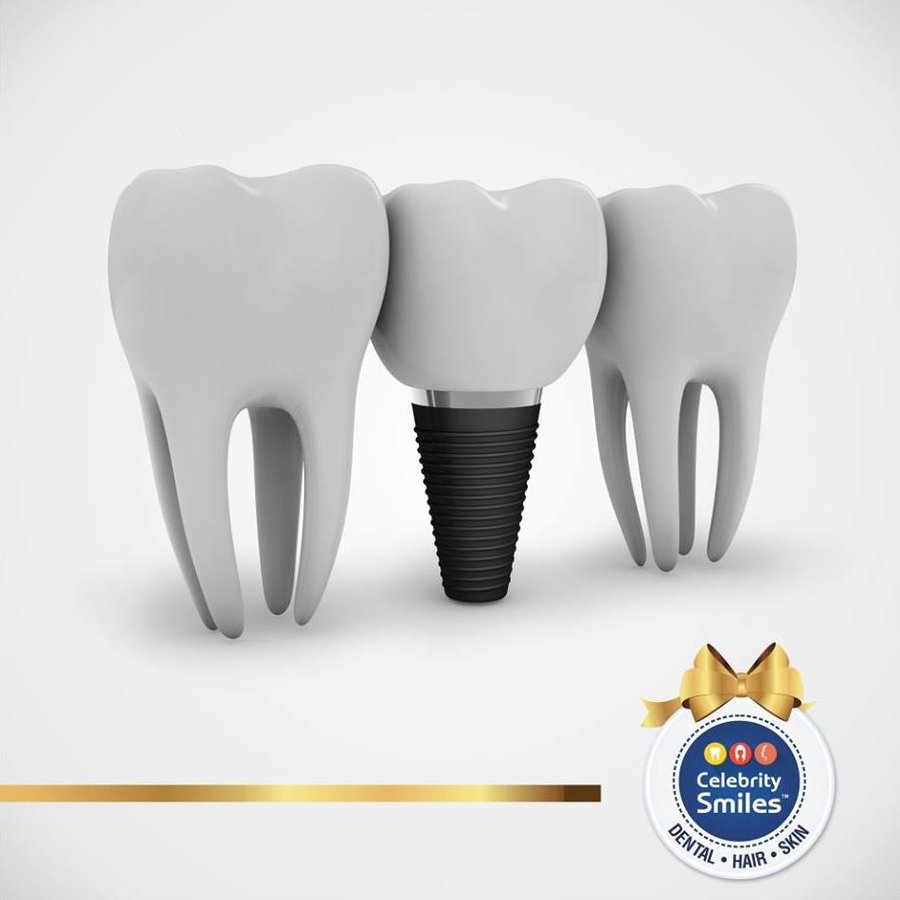 Celebrity Smiles - HSR Layout Clinic - Celebrity Smiles - HSR Layout Clinic