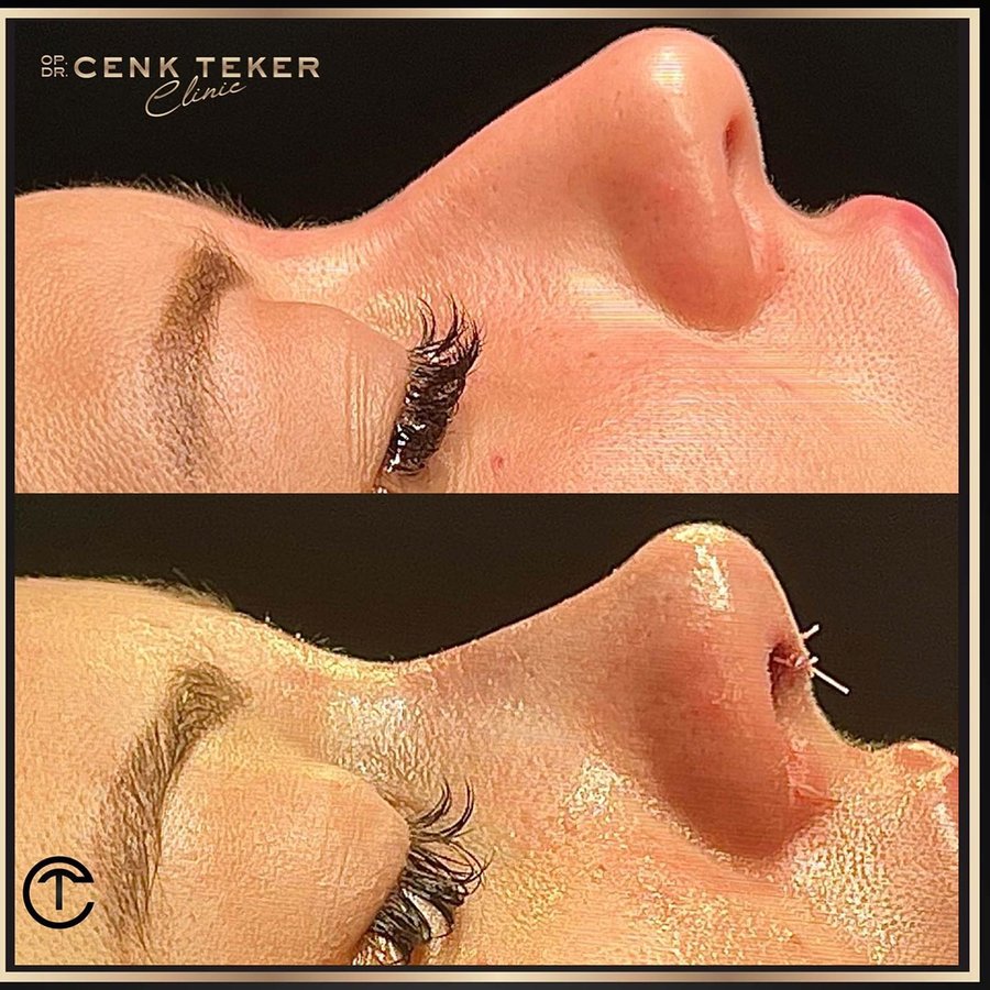 Cenk Teker Clinic - Cenk Teker Clinic
