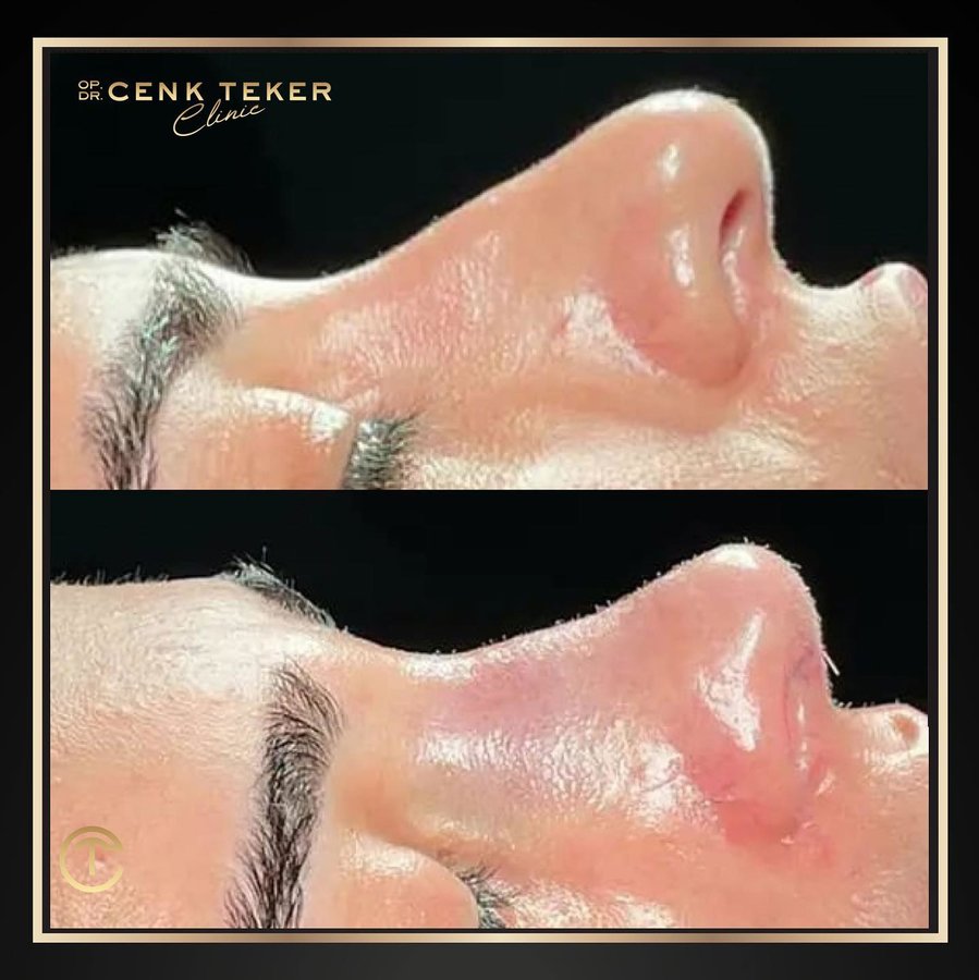 Cenk Teker Clinic - Cenk Teker Clinic