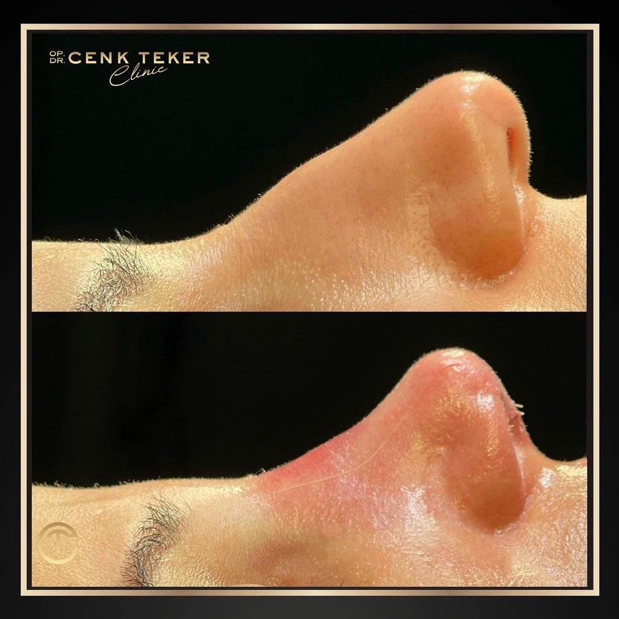 Cenk Teker Clinic - Cenk Teker Clinic