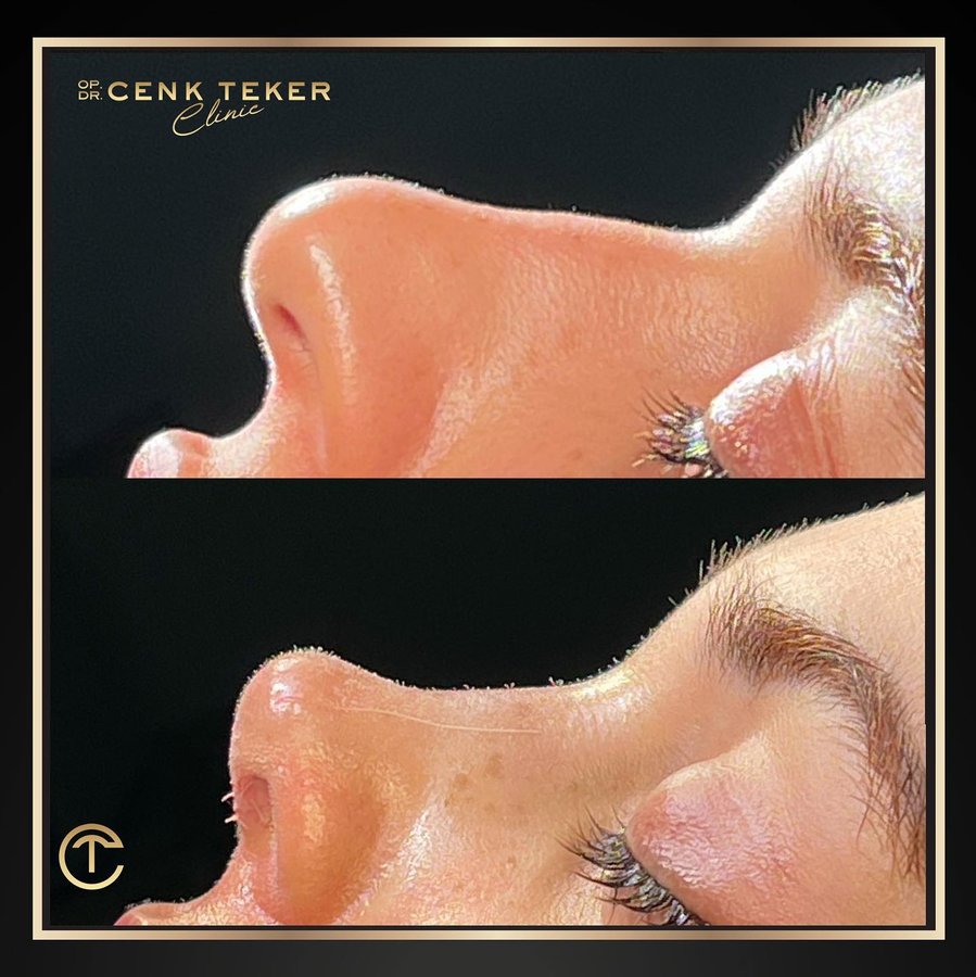 Cenk Teker Clinic - Cenk Teker Clinic