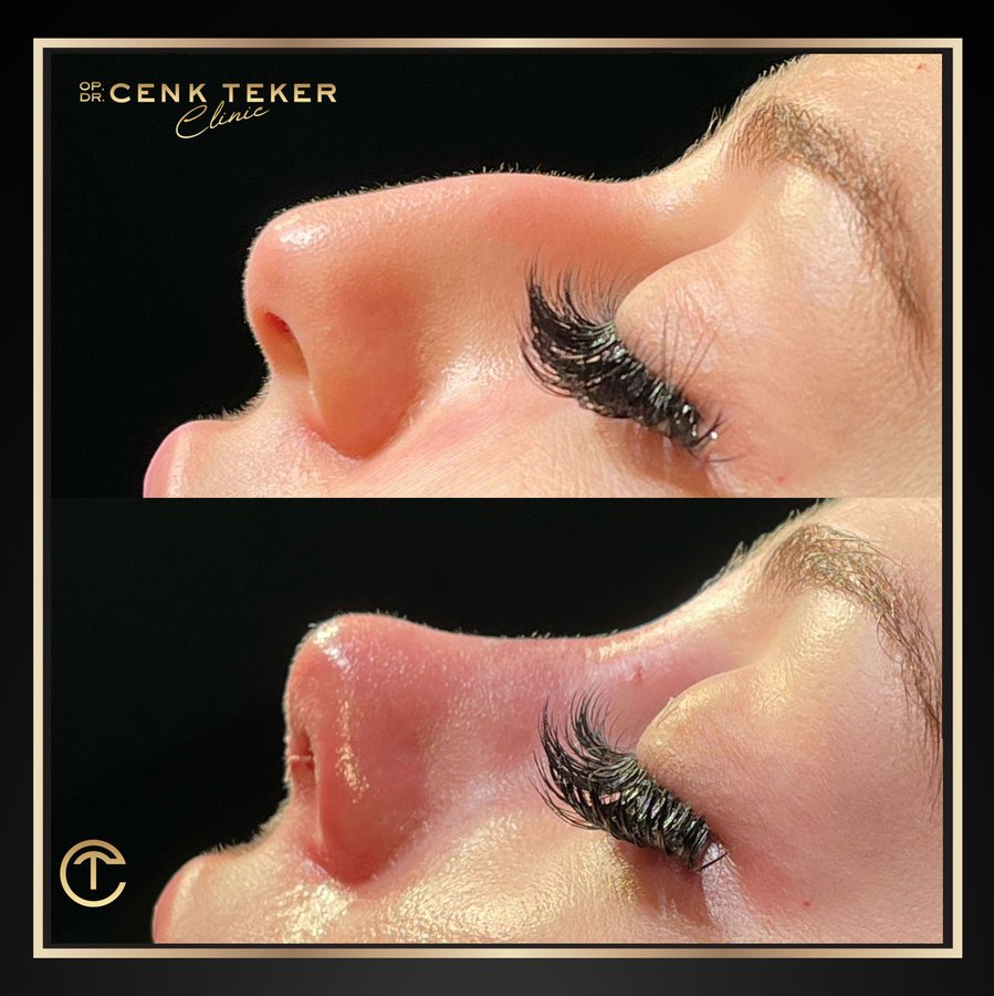 Cenk Teker Clinic - Cenk Teker Clinic