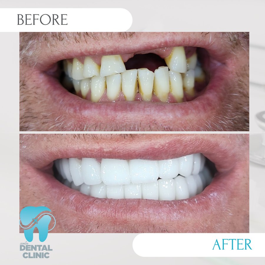 Center Dental Clinic - Center Dental Clinic