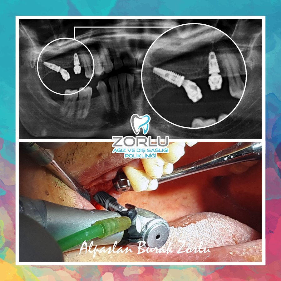 Center Dental Clinic - Center Dental Clinic