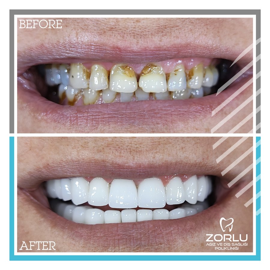 Center Dental Clinic - Center Dental Clinic