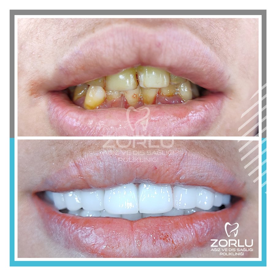 Center Dental Clinic - Center Dental Clinic