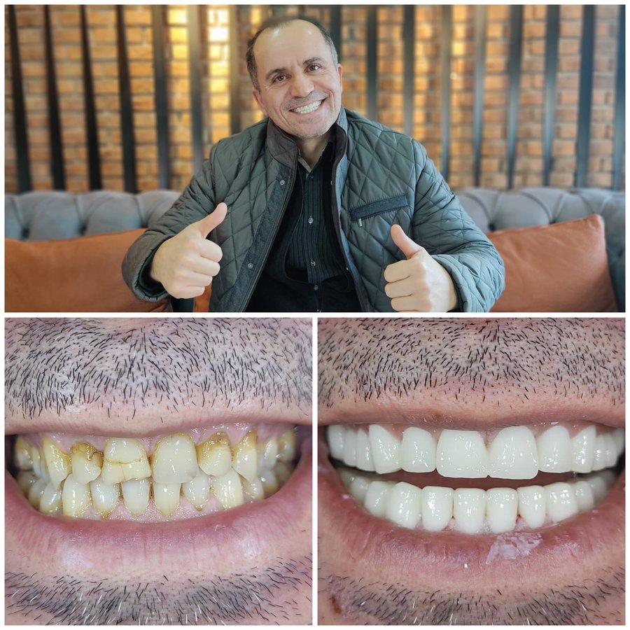 Center Dental Clinic - Center Dental Clinic