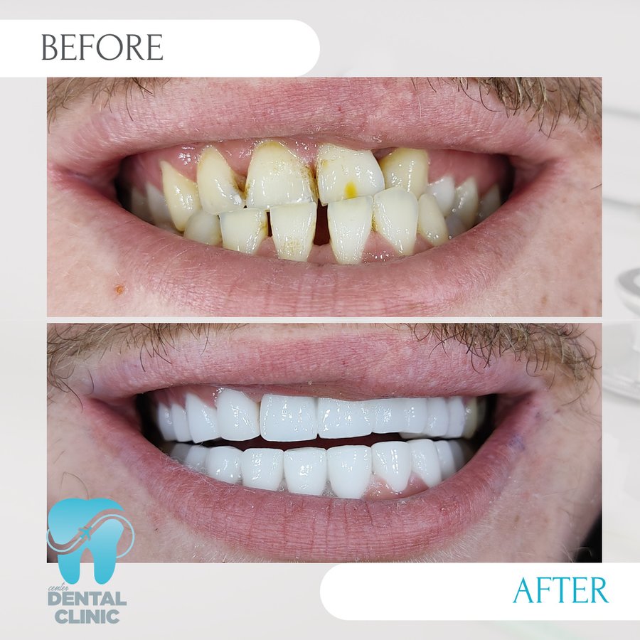 Center Dental Clinic - Center Dental Clinic