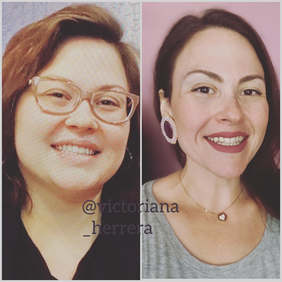 Center for Plastic Surgery and Specialties Santo Domingo (CECIP ) - Center for Plastic Surgery and Specialties Santo Domingo (CECIP )