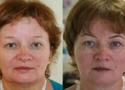 Center of Professional Micropigmentation "Pmc" - Center of Professional Micropigmentation "Pmc"