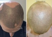 Center of Professional Micropigmentation "Pmc" - Center of Professional Micropigmentation "Pmc"