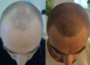Center of Professional Micropigmentation "Pmc" - Center of Professional Micropigmentation "Pmc"