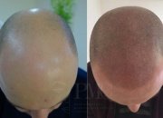 Center of Professional Micropigmentation "Pmc" - Center of Professional Micropigmentation "Pmc"