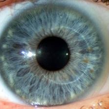 Center Ophthalmology Refractive Bresciano - Center Ophthalmology Refractive Bresciano