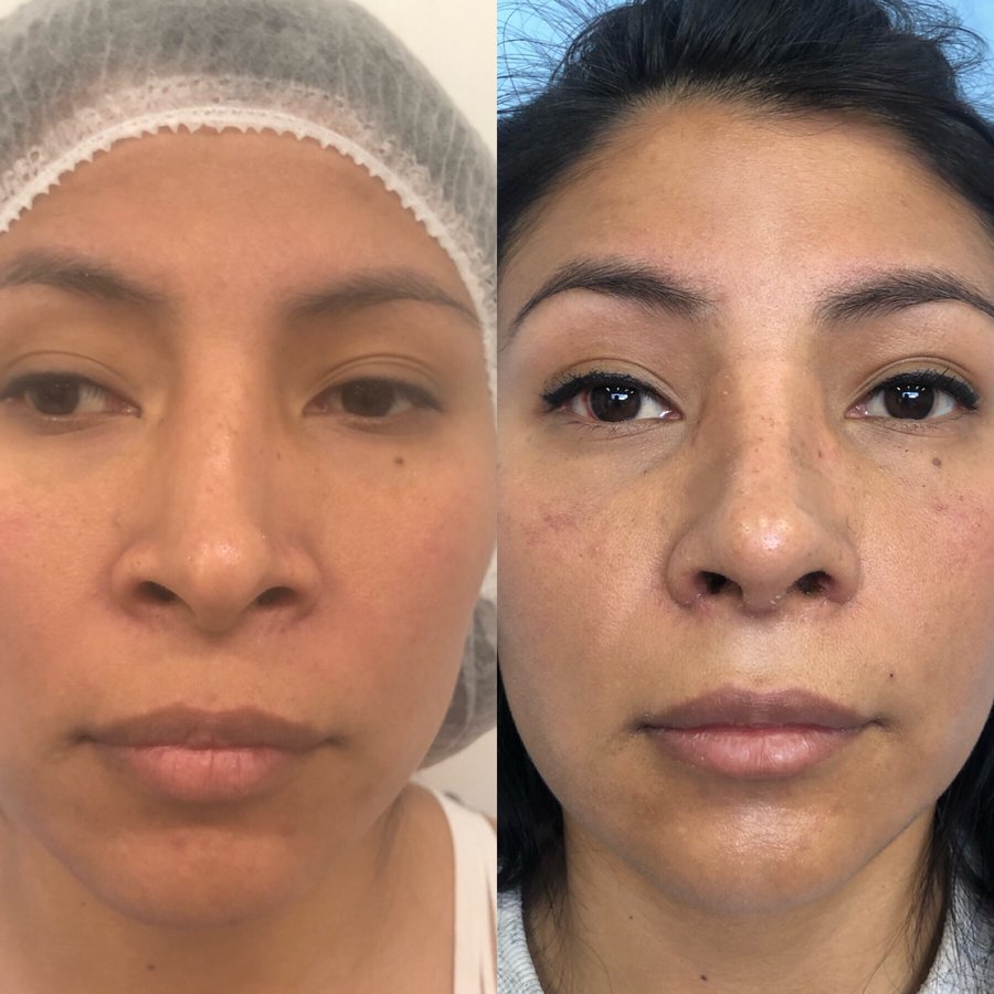 Centro Dr. Emiliano Alvarez - Centro Dr. Emiliano Alvarez