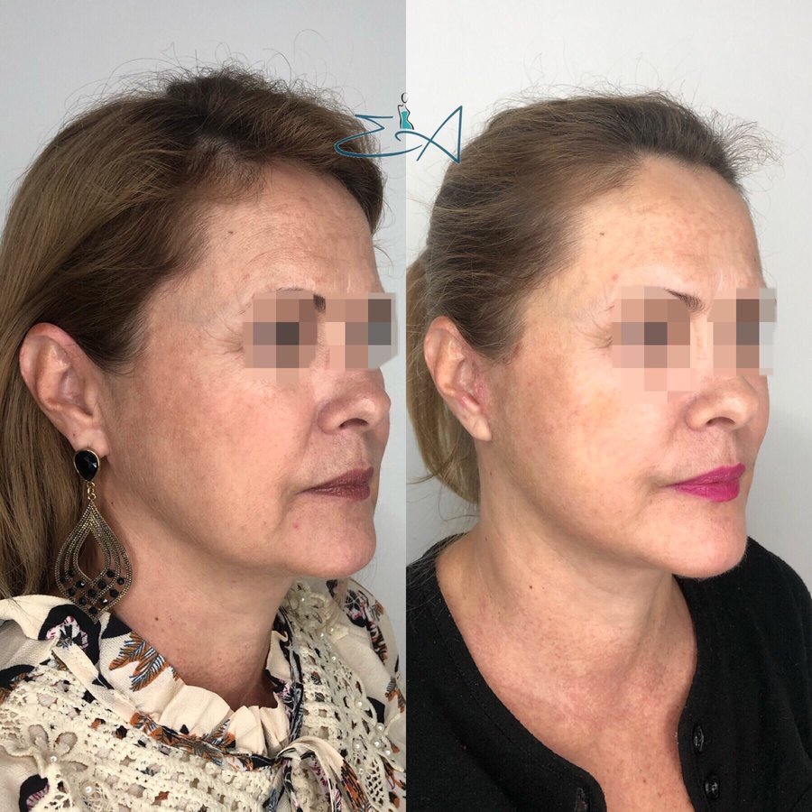 Centro Dr. Emiliano Alvarez - Centro Dr. Emiliano Alvarez