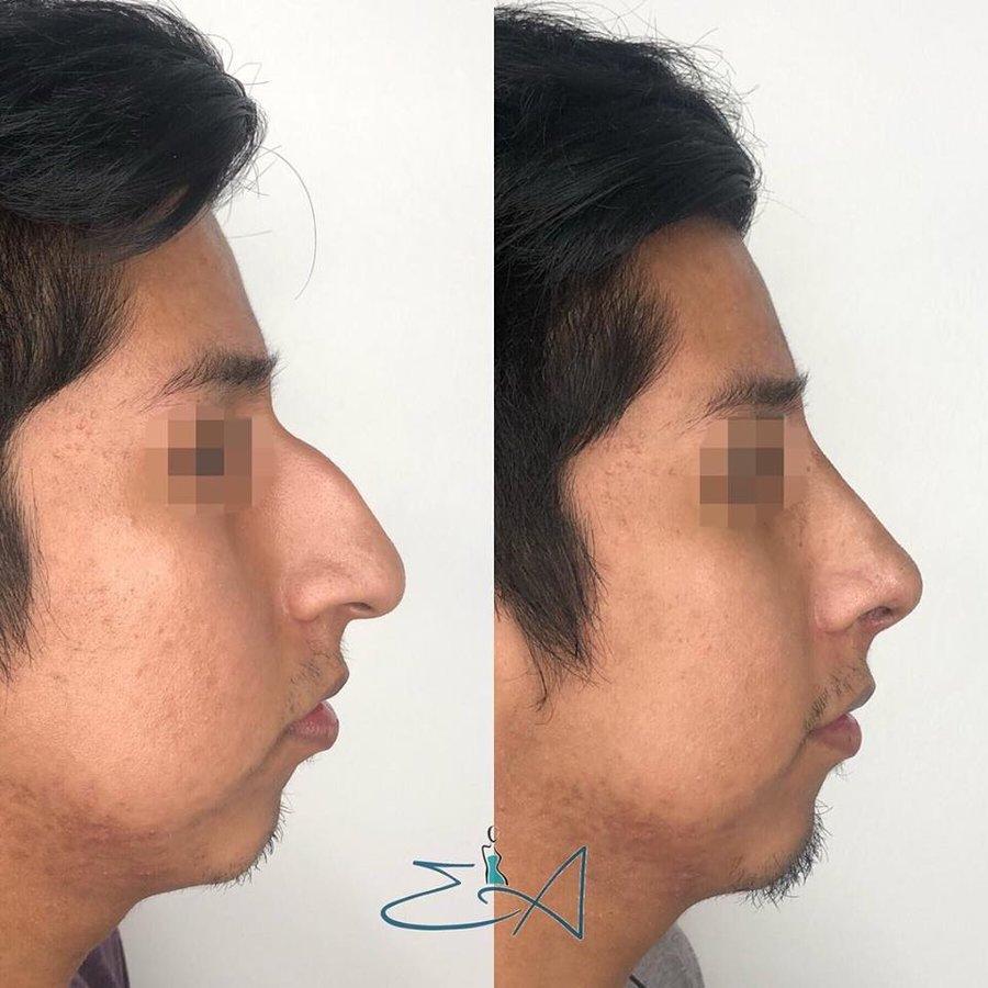 Centro Dr. Emiliano Alvarez - Centro Dr. Emiliano Alvarez