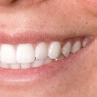 مركز طب الأسنان Tecnolgico - Centro Médico Dental Tecnológico