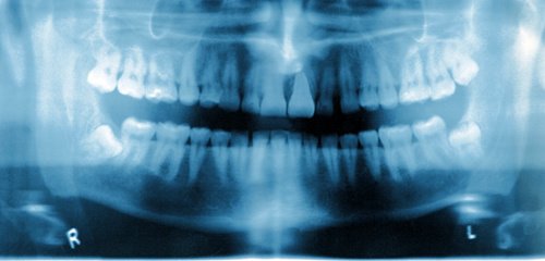 مركز طب الأسنان Tecnolgico - Centro Médico Dental Tecnológico