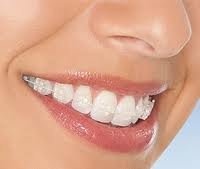 CENTRUL STOMATOLOGIC ZORILOR- DR.TUDOR POMANA - CENTRUL STOMATOLOGIC ZORILOR- DR.TUDOR POMANA